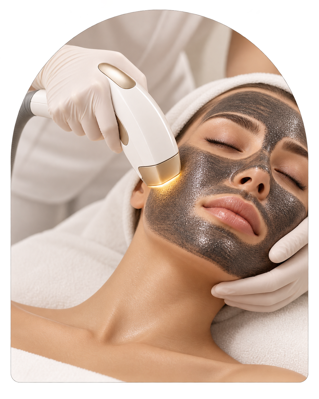 Carbon Laser Facial and Hollywood Peel at Galadia Medical Aesthetics Warrington