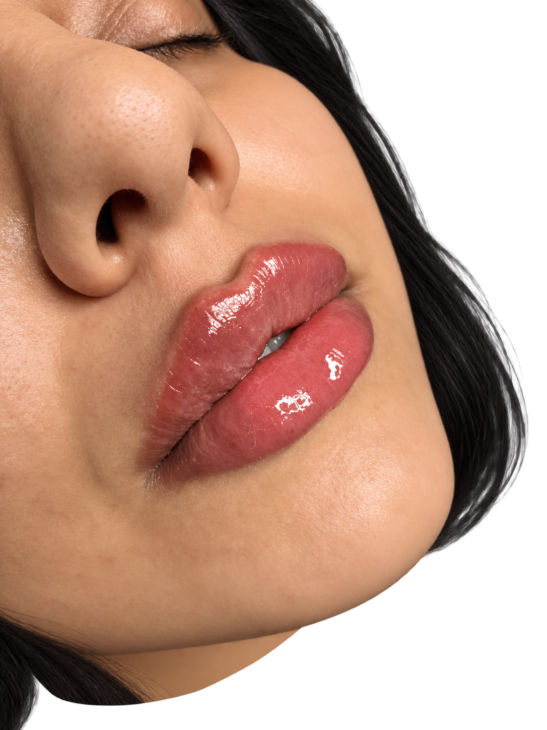 Injectable aesthetic treatments at Galadia Medical Aesthetics Warrington