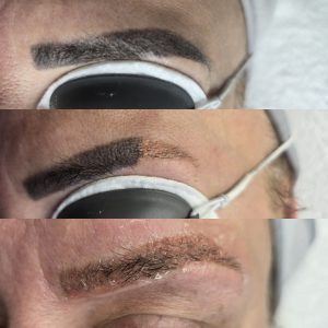 Eyebrow tattoo fading before new brow treatment Warrington