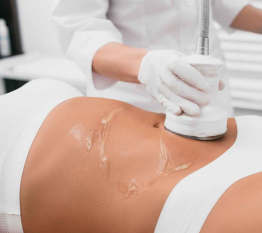 Body sculpting treatment example at Galadia Warrington